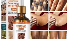 Dark Knuckle Whitening Serum Hand Elbow Knee Brightening Serum In Rei-Bouba City in Cameroon, Nigel And Saldanha Town Call +2771 073 2372 Get Rid Of Scars And Stretch Marks In Ambodiangezoka Town In Madagascar And Johannesburg South Africa
